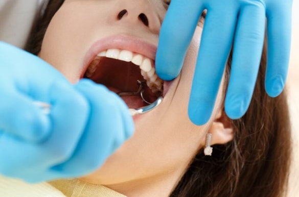 удаление зубов в спб